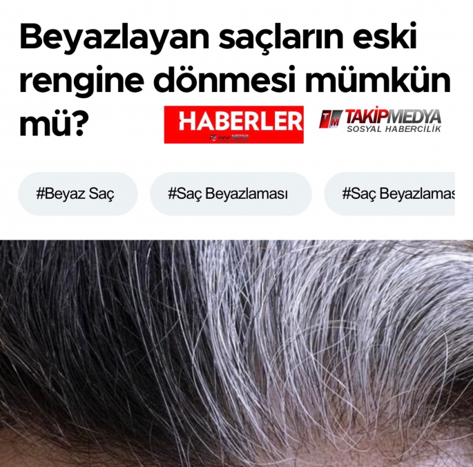 Beyazlayan saçların eski rengine dönmesi mümkün mü?